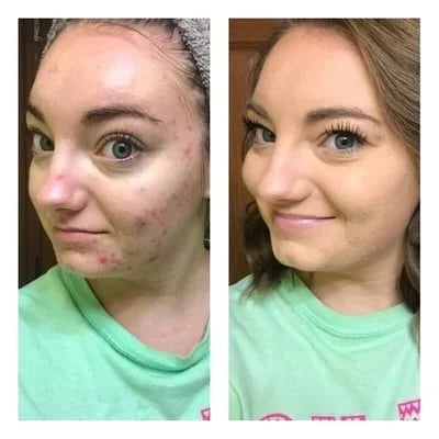 ✨Kupte 1 a získejte 1✨ Sada tříbarevného korektoru